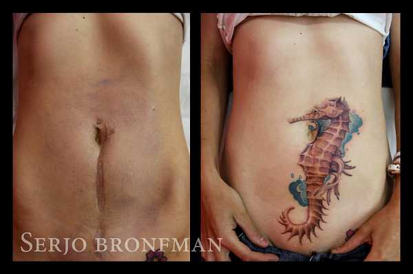 Tattoos lassen Narben verschwinden Tattoo Spirit