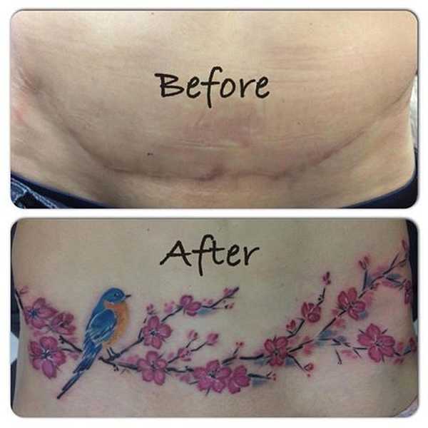 Tattoos lassen Narben verschwinden Tattoo Spirit